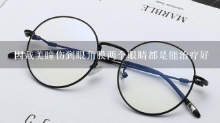 因戴美瞳伤到眼角膜两个眼睛都是能治疗好